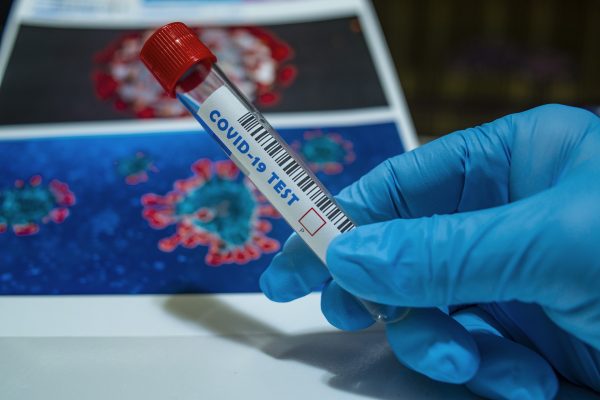 Hlavní město otevírá ve spolupráci s GHC Genetics dvě nová odběrová místa v Praze 6
